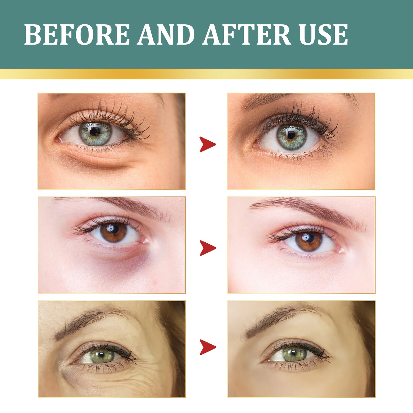 Eye Cream | Lightening Dark Circles, Anti-Aging