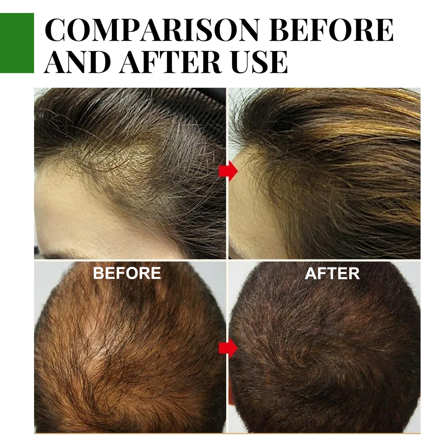 Rosemary Essential Oil | Gentle Scalp Care