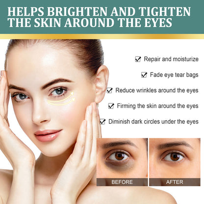 Eye Cream | Lightening Dark Circles, Anti-Aging