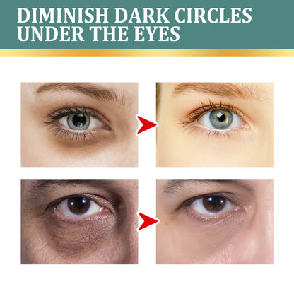 Eye Cream | Lightening Dark Circles, Anti-Aging