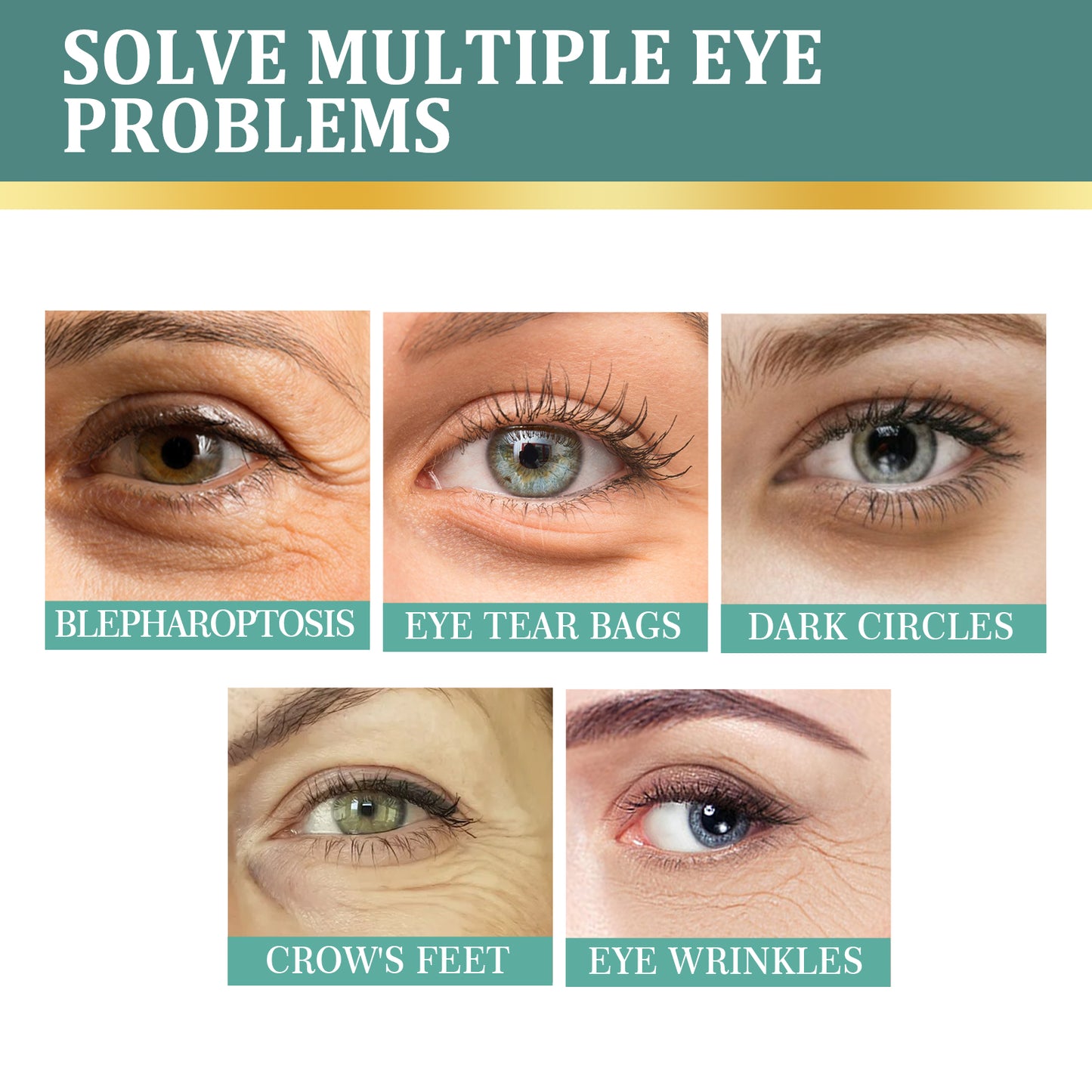 Eye Cream | Lightening Dark Circles, Anti-Aging