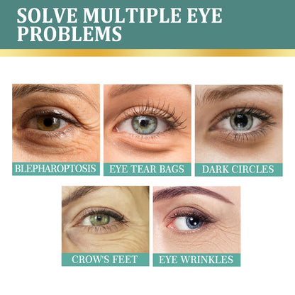 Eye Cream | Lightening Dark Circles, Anti-Aging