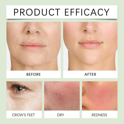 Collagen Tea Tree Skin Care Mask | Hydrating Box Set