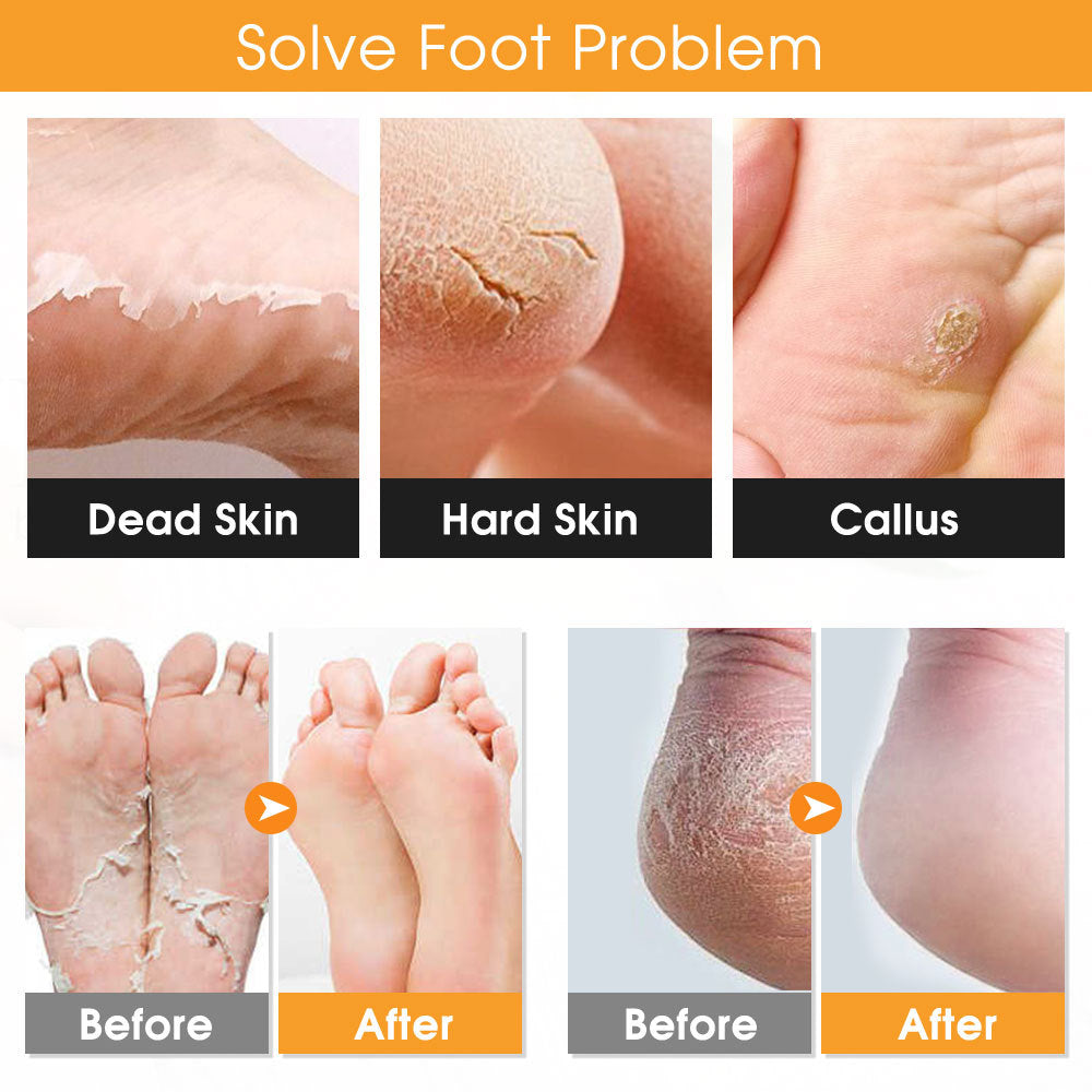 Foot Exfoliation Tool Set | 22-Piece, White