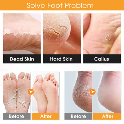 Foot Exfoliation Tool Set | 22-Piece, White